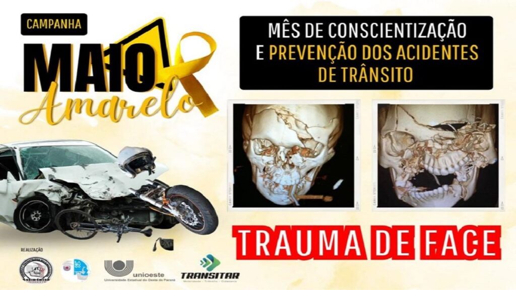 Maio Amarelo: Cirurgias de reparação craniofaciais aumentaram mais de 70% no Huop